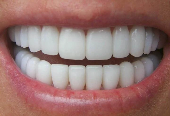 Plantilla de Dientes perfectos | Dientes imperfectos numero 3